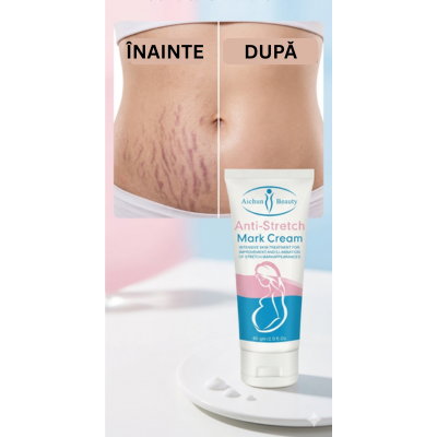 Crema pentru vergeturi Aichun Beauty cu uleiuri esentiale