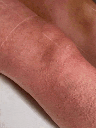 Serul Epilator Anti-Iritații cu extract de Cyperus Rotundus